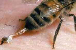 Può essere salutare e terapeutico: è il veleno delle api
